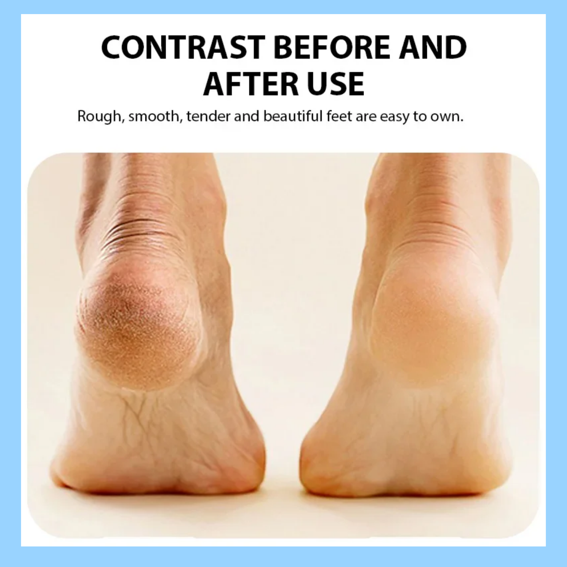 Rechargeable Foot Grinder™