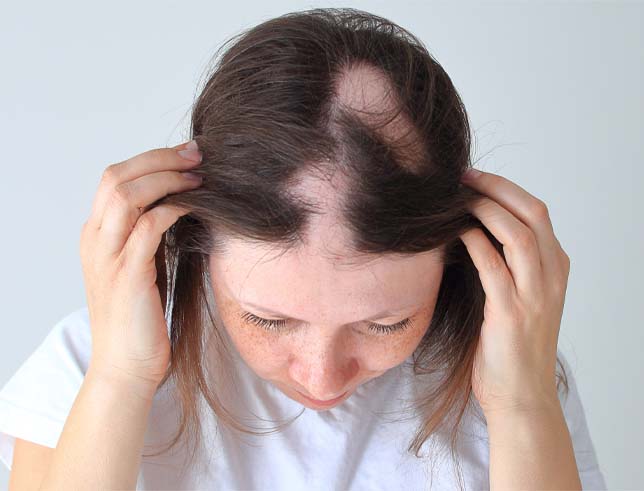 Hair Loss: Causes, Symptoms, and Evidence-Based Treatments for Regrowth