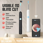 Smart Visual Ear Cleaner