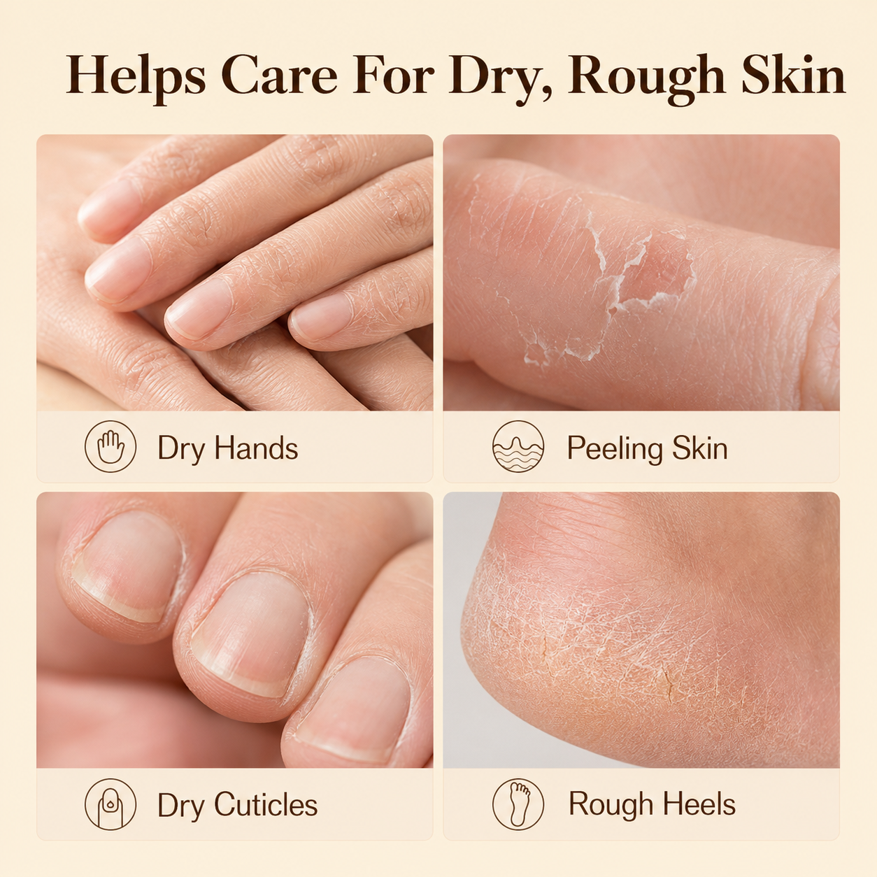 Wellzonez™ Moisturizing Heel Balm